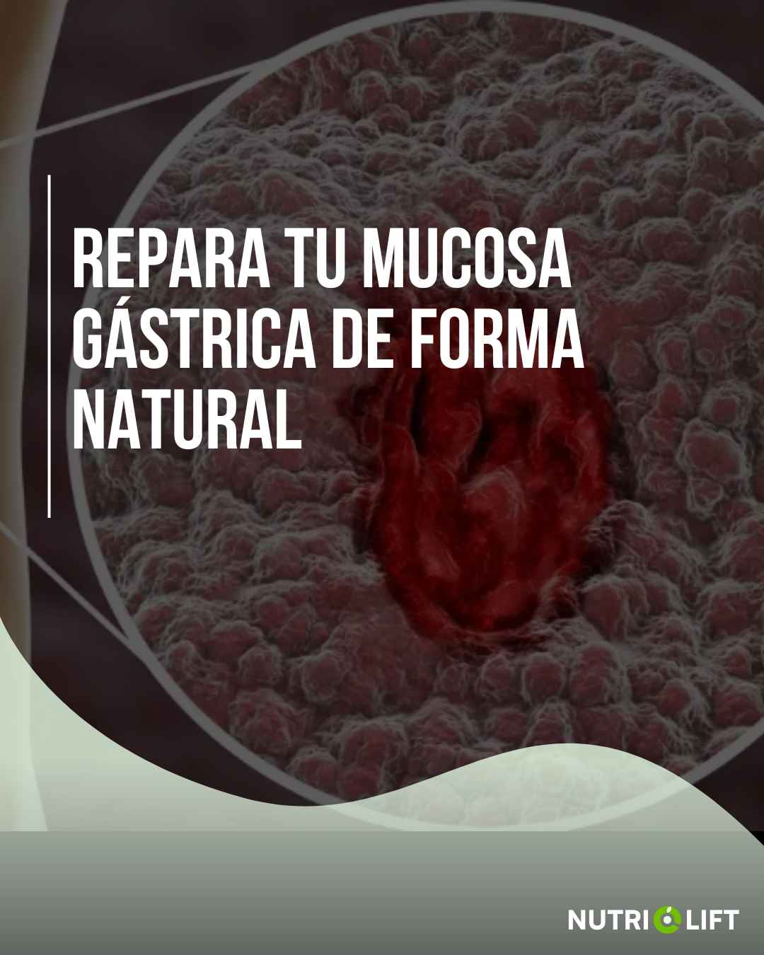 Repara tu mucosa gástrica de forma natural
